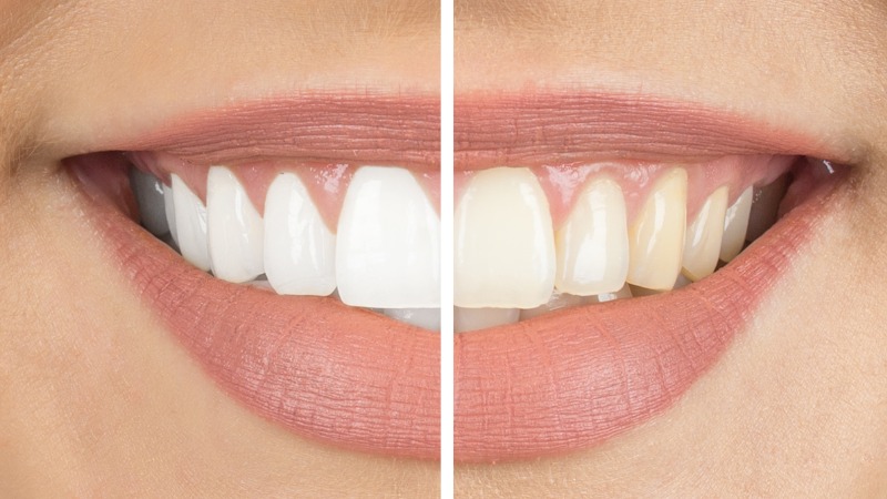 Dentifrice blanchissant